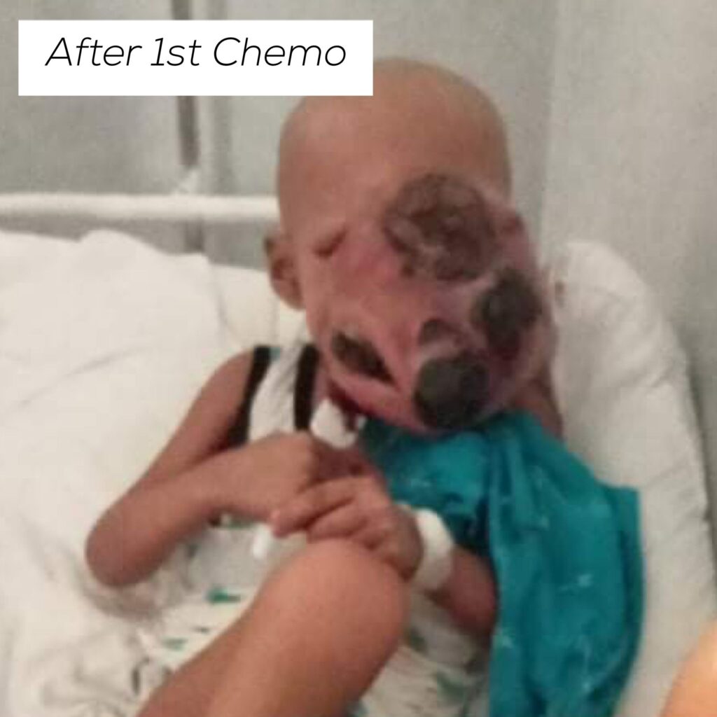 baby john child face tumor cancer philippines 5