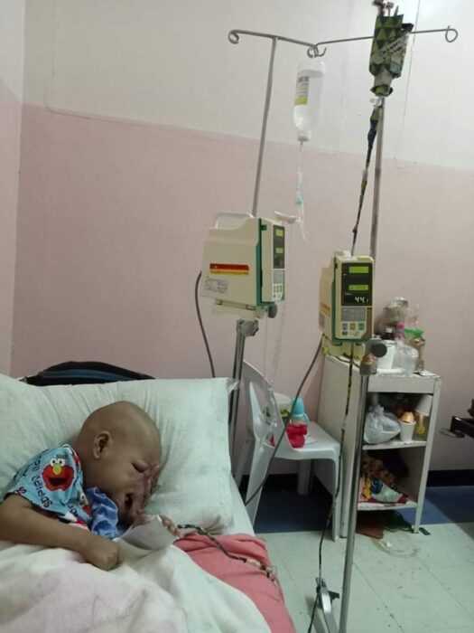 baby john child face tumor cancer philippines chemo